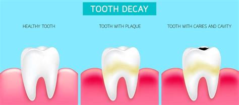 are teeth generic
